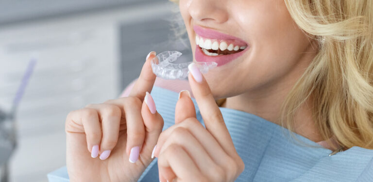 women holding Invisalign clear aligners, about to set the aligners on her top row of teeth