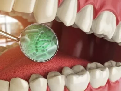 illustration of teeth with bad breath