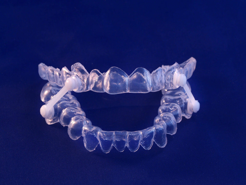 picture of sleep apnea appliance